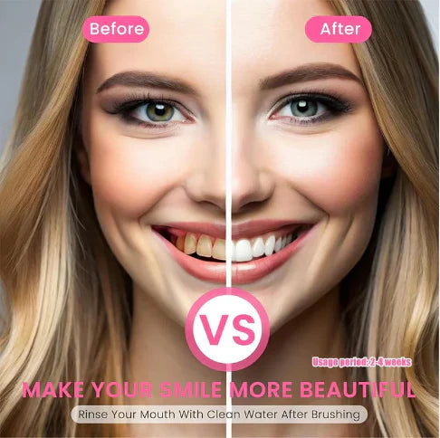 Niacinamide Whitening Toothpaste - For Teeth Whitening & Health!